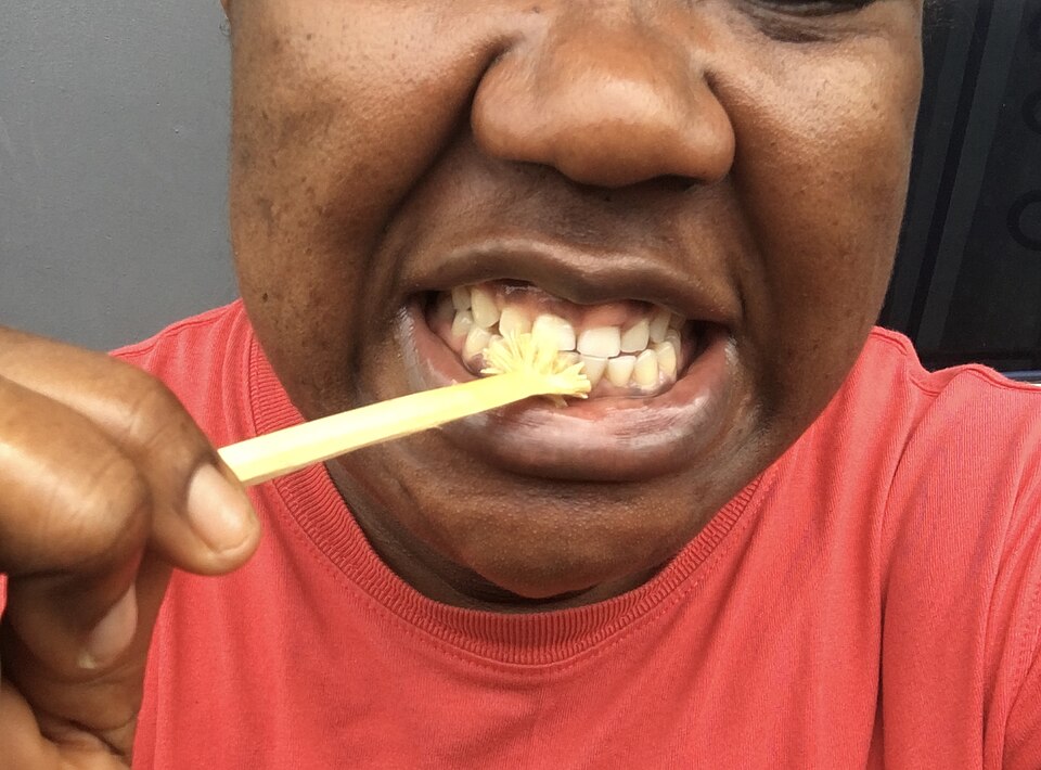 Cleaning teeth with a chewing stick: the end is chewed until its fibres splay into a brush, then worked along the teeth and the gum line. The used end is cut off and a fresh one chewed.