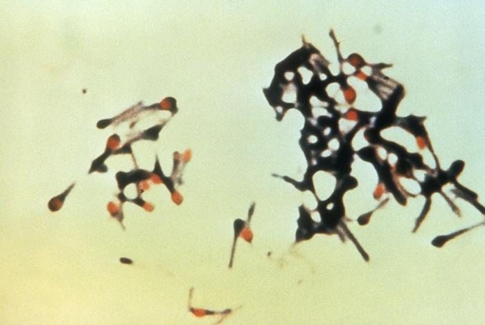 Clostridium tetani: rods each carrying a round spore at one end, like a drumstick. The spores live in soil and dung, survive boiling, and cause tetanus when they reach a deep wound.
