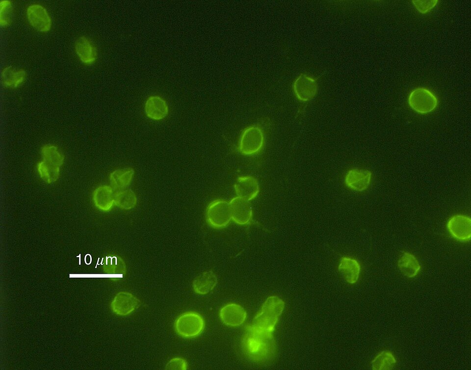 Cryptosporidium parvum oocysts, fluorescent stain, with a 10 µm scale bar: each is 4–6 µm across. Chlorine at drinking-water doses does not kill them; a 1 µm filter holds them back and boiling kills them.