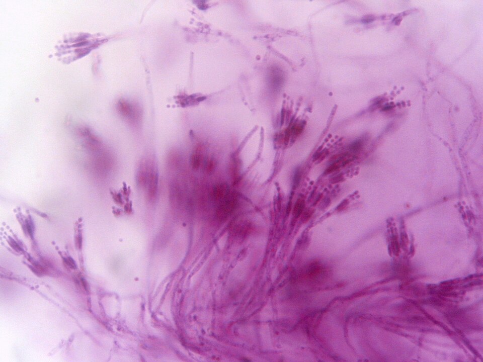 Penicillium under the microscope. The mould that made bacterial infection survivable.