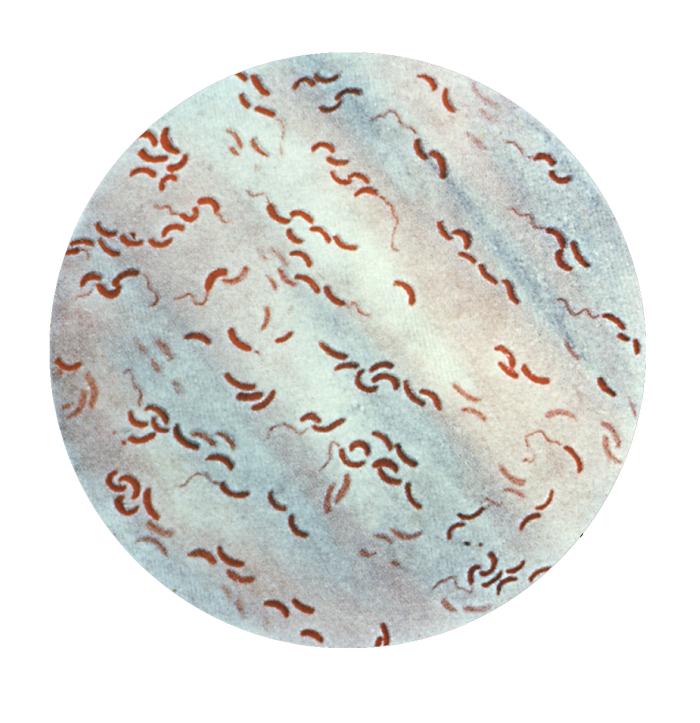 Vibrio cholerae, stained, under the light microscope: short curved rods shaped like commas. One litre of cholera stool can hold billions of them.